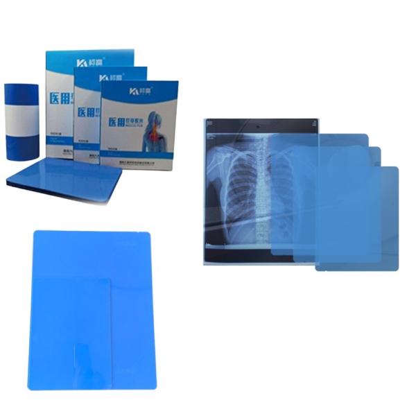 Free Sample Inkjet X Ray Paper Film Imaging Printed By Printer For Radiology