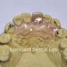 Buy cheap Dental TCS Valplast Flexible Partial Dentures Staining Fading Odors Resistant from wholesalers