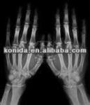 Medical X Ray Thermal Printer Film KND-F25*30cm