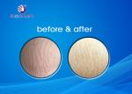 20W Cavitation Vacuum Slimming Machine Stretch Mark Improvement CE Approval