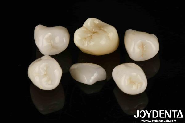 Buy cheap Easy Cementation Emax Inlay Onlay Medium Strength Natural-looking Esthetics from wholesalers
