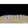 Buy cheap Long-lasting And Stain Resistant Dental Veneers With Personalized Shades For Natural Teeth from wholesalers