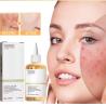 Buy cheap Private Label 7% Face Toner Glycolic Acid Toning Solution Dry/Oily/Sensitive Skin Care Face Exfoliator Spray for Adults from wholesalers