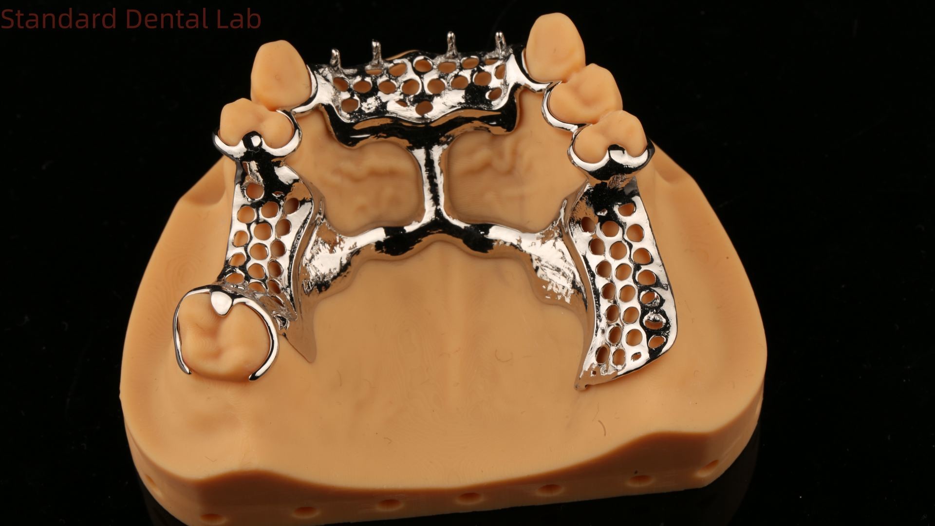 Upper Cast Framework Acrylic Metal Partial Dentures Strong Lightweight and Durable