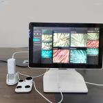 Medical Level Hair Care Skin Analysis Machine With Intelligent Analysis