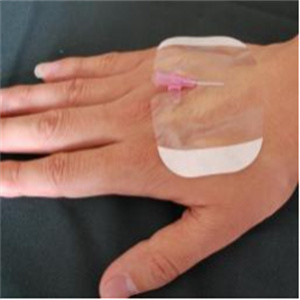 Hospital Disposable Transparent Adhesive Film Dressing Transfusion Needle