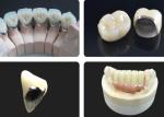 Moderate Translucency Porcelain Fused To Metal PFM Crown , PFM Ceramic Crown