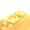 Buy cheap Precision Light Cure Resin Radiopaque Dental Resin For 3d Printing from wholesalers