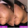 Buy cheap Alcohol Free Skin Molecules Discoloration Correcting Serum Tranexamic Acid Niacinamide For Dark Age Spots from wholesalers