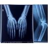Buy cheap 14x17 laser x-ray film FUJI DI-HL (14x17") / (35x43cm) Medical Laser Film fuji dry film from wholesalers