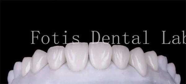 Buy cheap Polishing Finishing Cosmetic Teeth Veneer Covers For Beautiful Smile from wholesalers