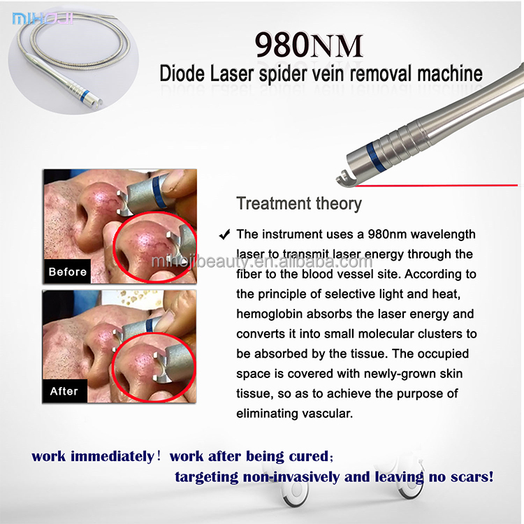 Liposuction Spider Vein Removal Machine 1470nm Diode Laser With Air Cooling