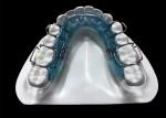 Mouthpieces Dental Tooth Orthodontic Appliances , Orthodontic Ligature Ties