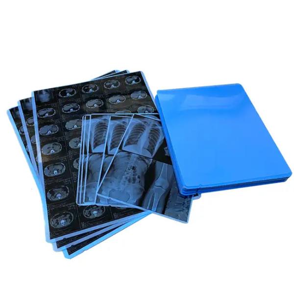 Buy cheap Medical Blue X - Ray Film For Laser Printing Medical Hosiptal Consuables from wholesalers