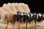 Oral Clinical Repair FMC Full Metal Crown Made With Wax Casting Production