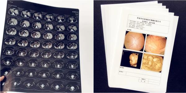 Medical Supplies Laser Print Film White Opaque Medical X-ray Film Image Printing
