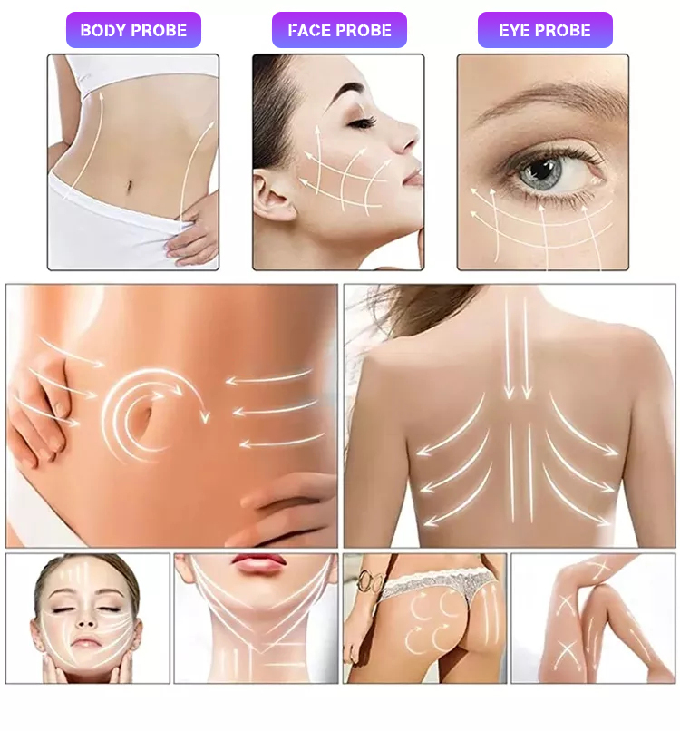 DPL Skin Tightening Vacuum Roller Handle for Body Slimming Infrared Negative Pressure RF Liposuction Slim Machine