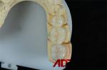 Buy cheap Biocompatible Ceramic 3D Emax Veneers For Tooth Restorations from wholesalers