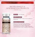 Organic Herbal Serum Anti Acne Customized Label Dermapen Face Essence For Oily