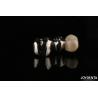 Buy cheap Abrasion Resistant Metal Alloy Crown For Customized Dental Restorations from wholesalers