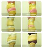 Mitsubishi non invasive diode lipo laser slimming strawberry i lipo laser