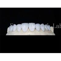 Buy cheap Customized Natural Porcelain Veneers Dental Lab Veneers Stain Resistant product