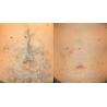 Buy cheap Triple wavelength diode laser machine fro hair removal from wholesalers