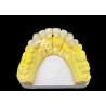 Buy cheap Achieve a Perfect Smile with High Quality Ceramic Dental Crowns for Natural Appearance and Durable Strength from wholesalers