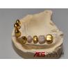 Buy cheap ADS Precision Attachment Dental Telescopic Crowns Mechanism from wholesalers