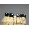 Buy cheap ODM Dental Prosthesis Crown Telescope Precision Attachment Denture from wholesalers